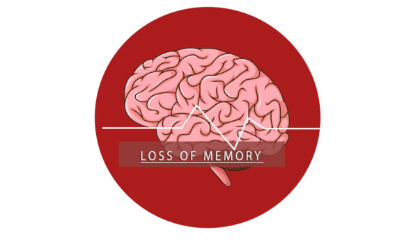 LOSS OF MEMORY TREATMENT PACK